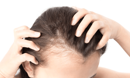 HOW CAN I STOP MY HAIR LOSS